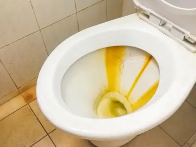 klozetteki sarı lekeler nasıl çıkar